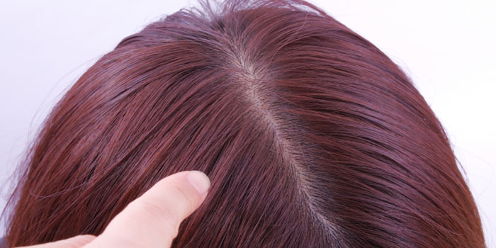 亜鉛が髪の毛に与える効果は？育毛や薄毛改善は期待できる？