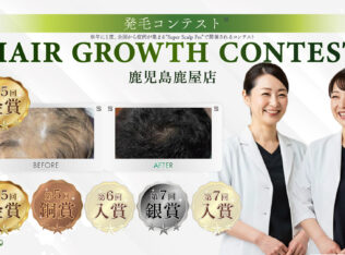 内観