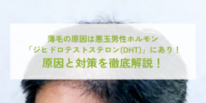 発毛・育毛コラム アーカイブ - スーパースカルプ発毛センター