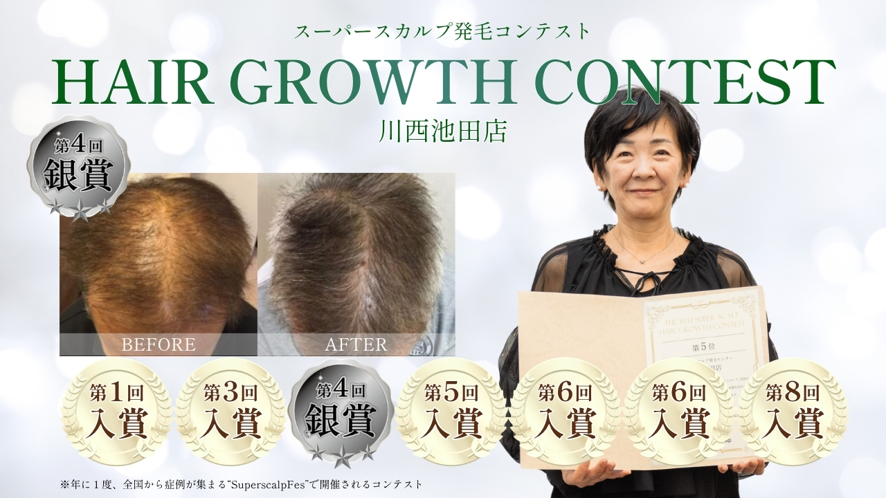 内観