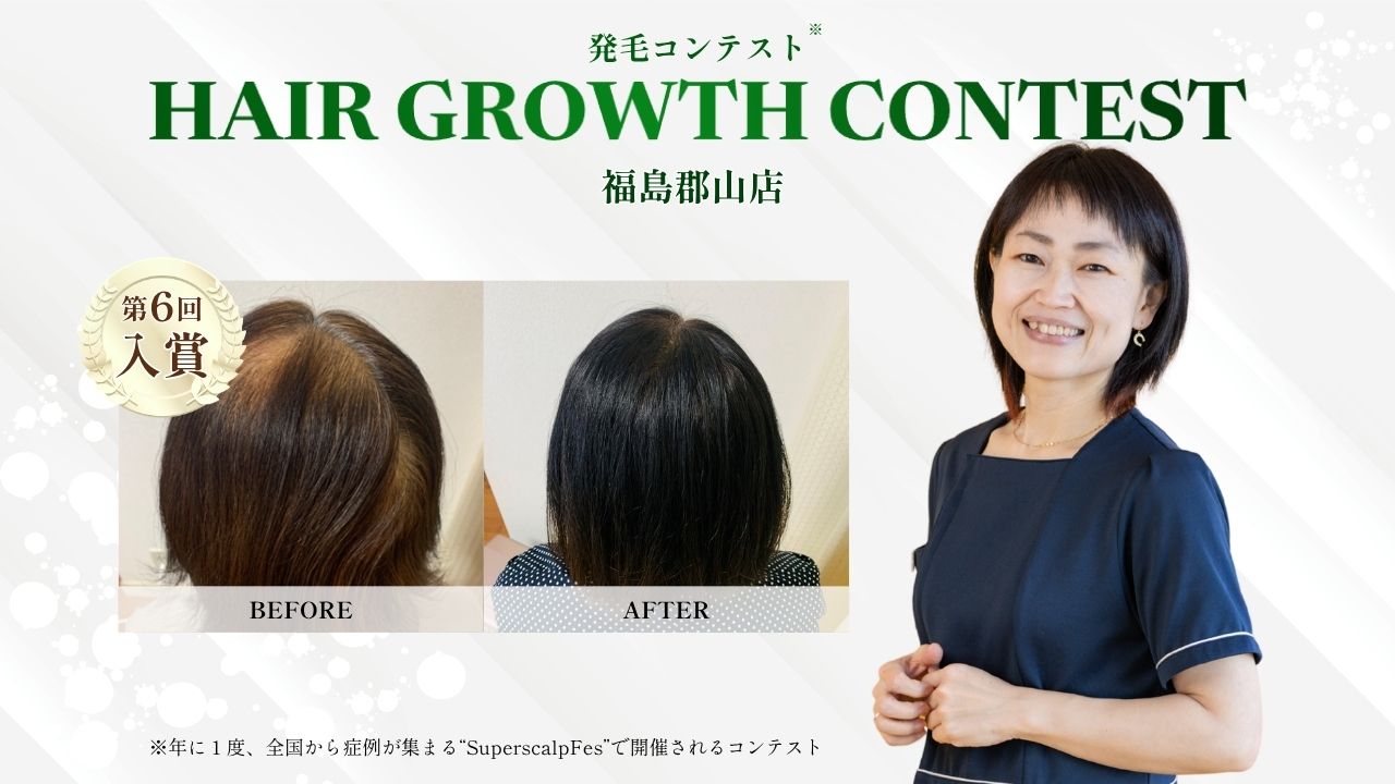 内観
