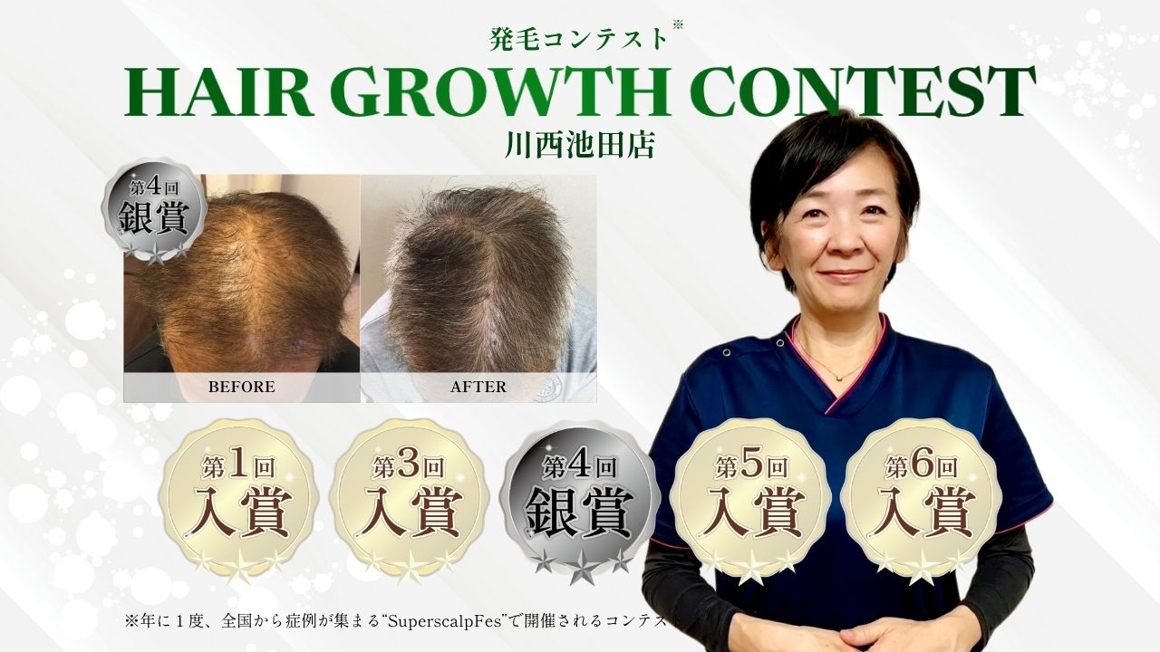内観