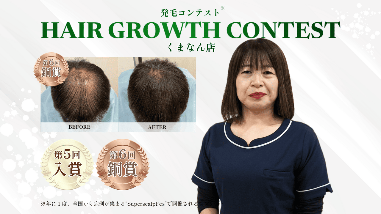 内観